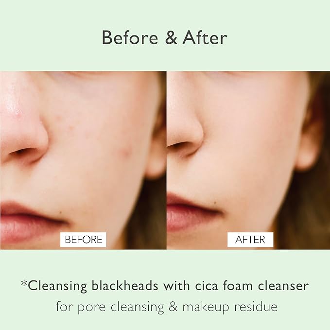 NOWATER Cica Pore Cleansing Foam | Pore Cleansing and Sebum Control | Cica, Hyaluronic Acid, Aloe | Daily Face Wash | Korean Skin Care for face (4.05 fl.oz)